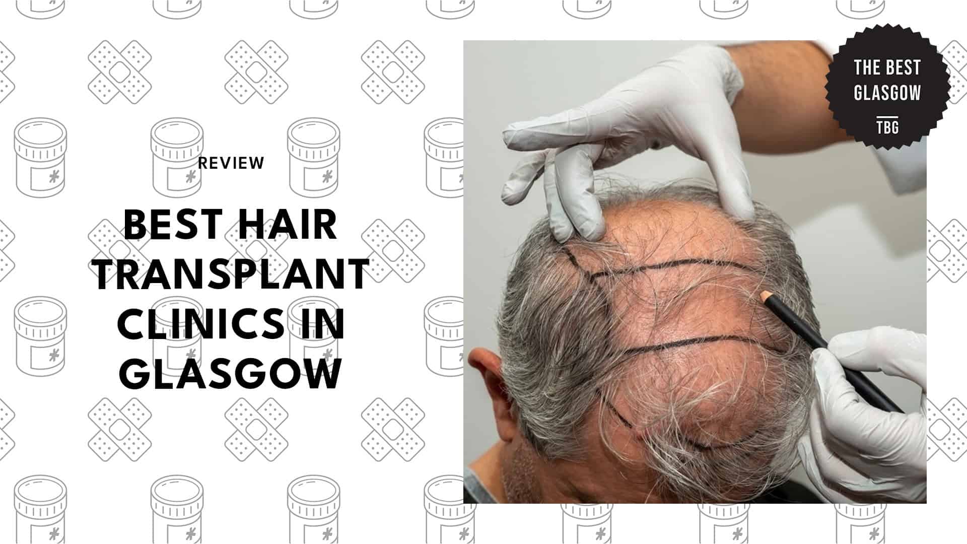 best-hair-transplant-glasgow-banner